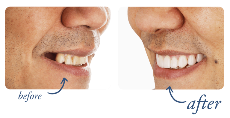 IMG-smile-makeover-02-min