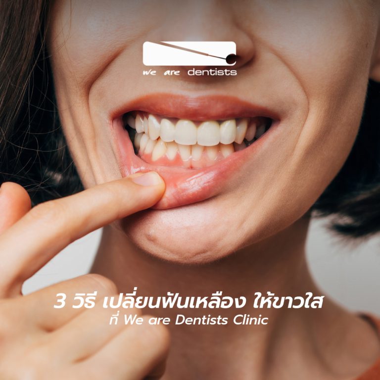 Revised - UPDATE - AW CONTENT (WAD-DEC